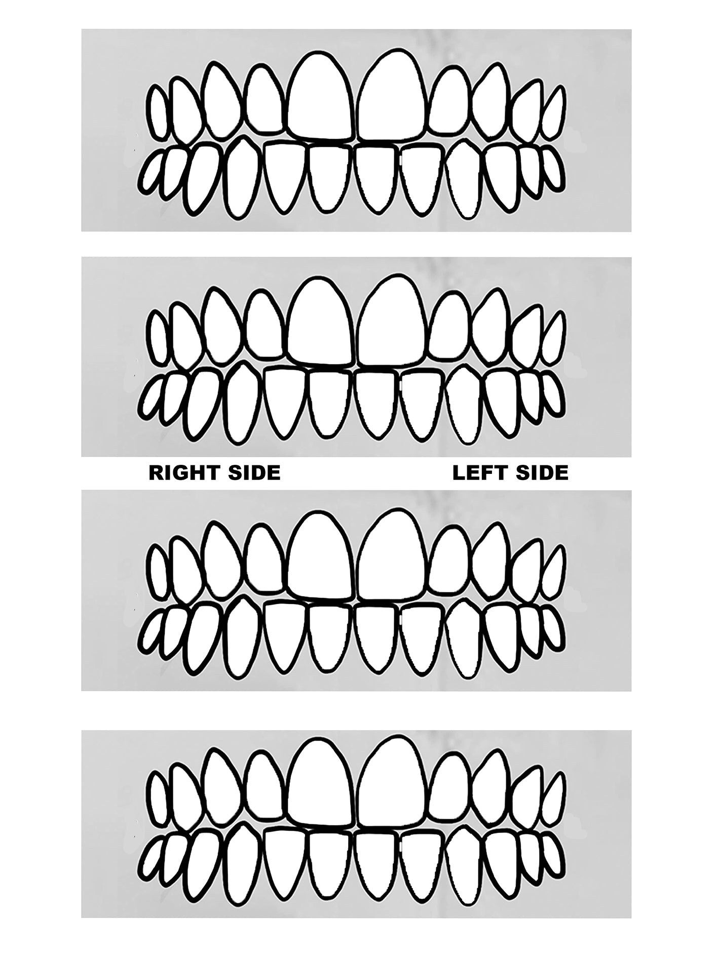 GRILLZ